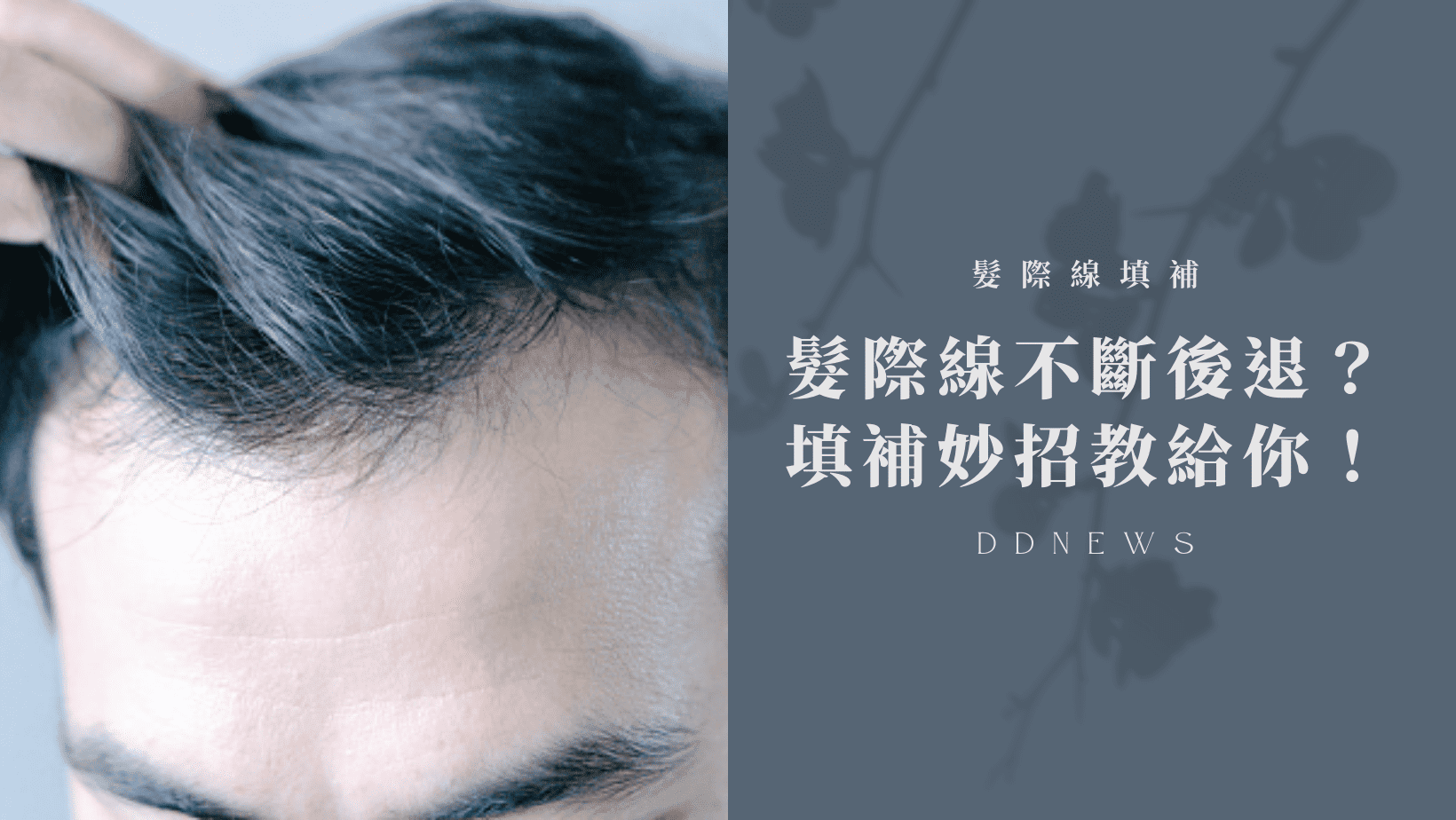 彩妝美容 髮際線不斷往後退?這個填補妙招你一定要試試!