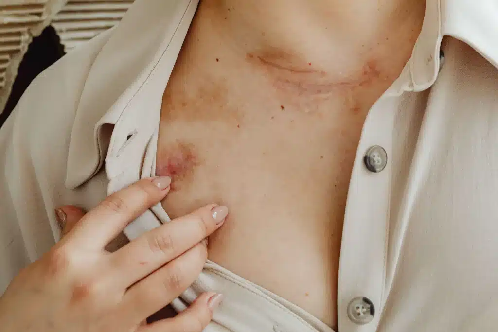 敏感性肌膚如何保養?破除迷思與3大NG行為 敏感性肌膚如何保養?破除迷思與3大NG行為
