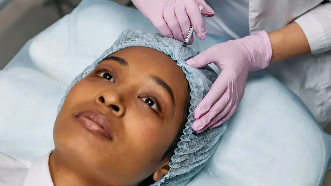 真皮填充劑 (Dermal Fillers)