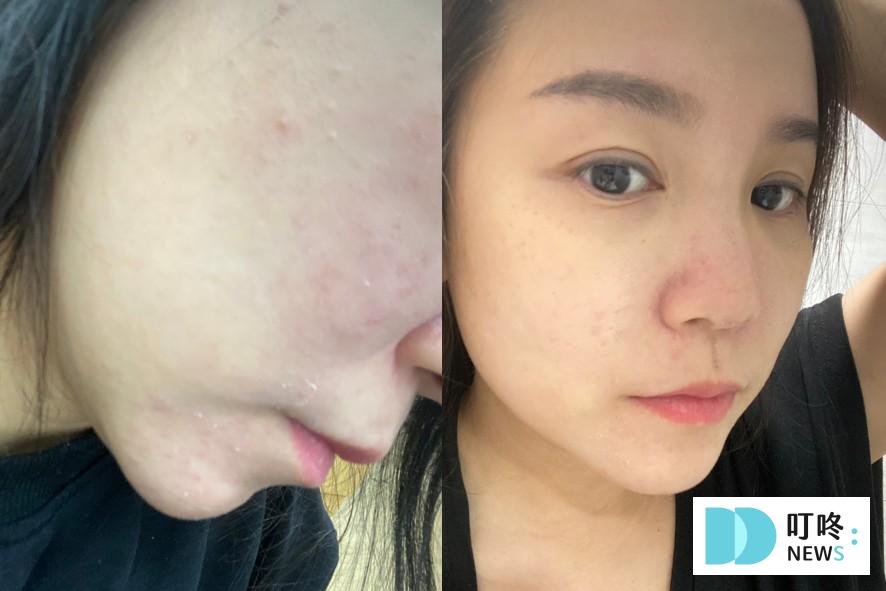 【理膚寶水多容安舒緩濕潤乳液】臉部開架乳液開箱:敏感肌專用,益生菌配方安心乳液 理膚寶水多容安舒緩濕潤乳液