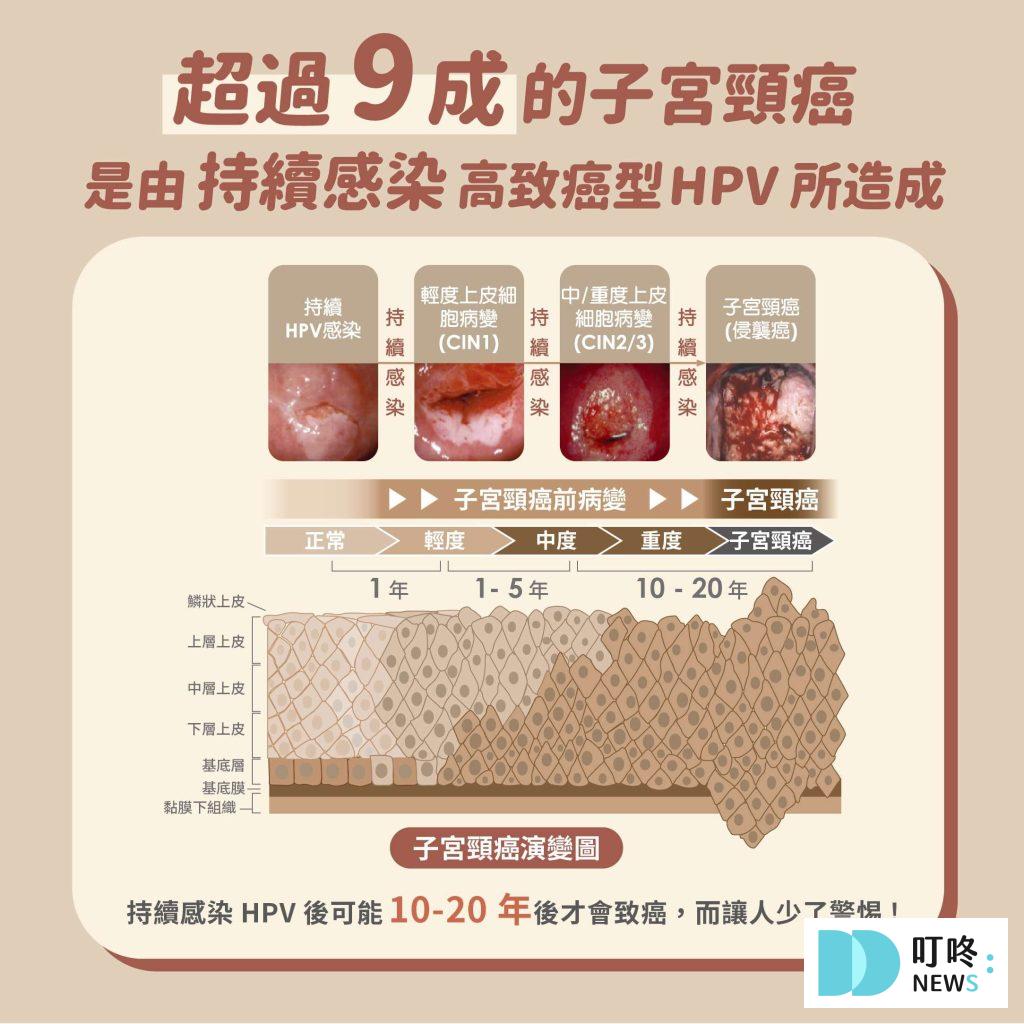 【HPV疫苗】常見問題Ｑ＆Ａ