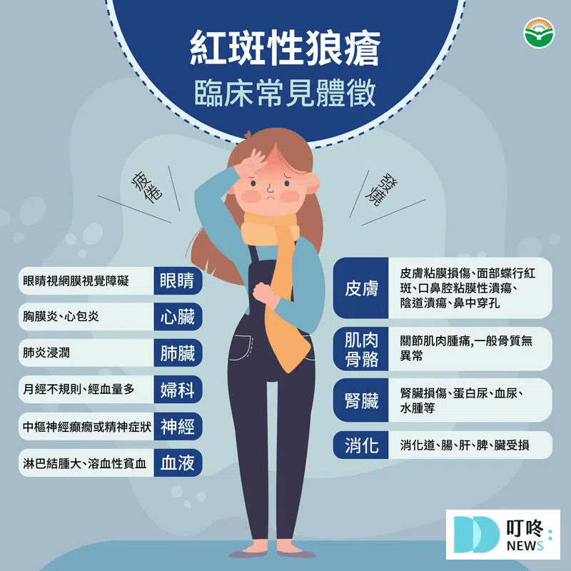 紅斑性狼瘡症狀