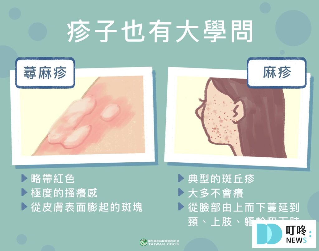 麻疹疫苗