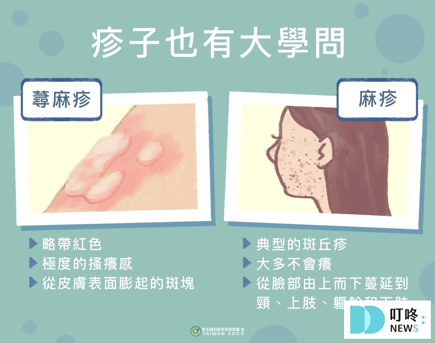 【麻疹疫苗(MMR)懶人包】麻疹是什麼?副作用、施打對象、哪裡打、預約資訊報你知 2026