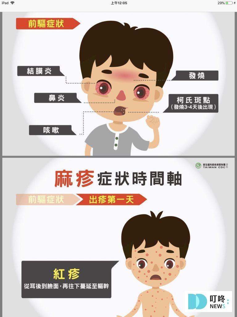 【麻疹疫苗(MMR)懶人包】麻疹是什麼?副作用、施打對象、哪裡打、預約資訊報你知 2025 麻疹疫苗