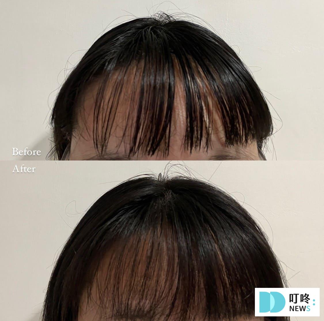 KOSE BIOLISS 輕盈蓬鬆瀏海蜜粉|開箱評價、實測心得一次看,油膩扁塌瀏海的救星 叮咚News|分享新奇與樂趣